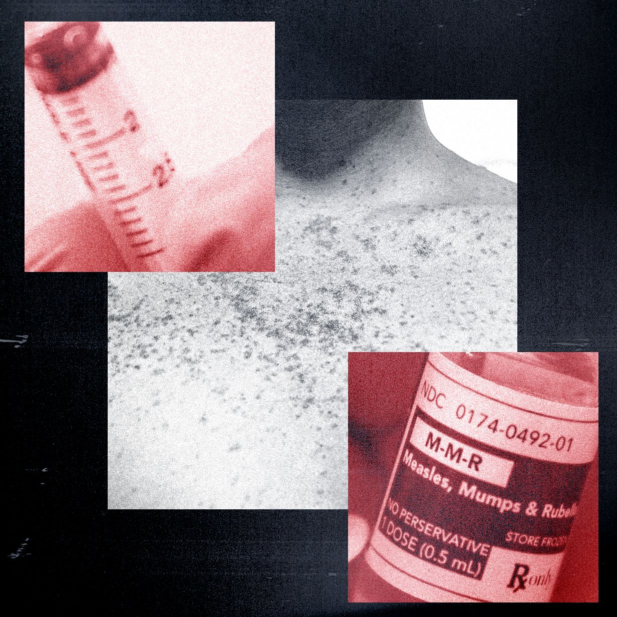 Anti-Vaxxers Are Grifting Off the Measles Outbreak—and Claim a Bioweapon Caused It